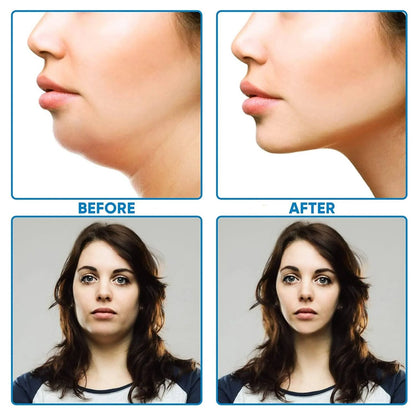 Double Chin Reducer – Reusable V-Line Lifting Mask