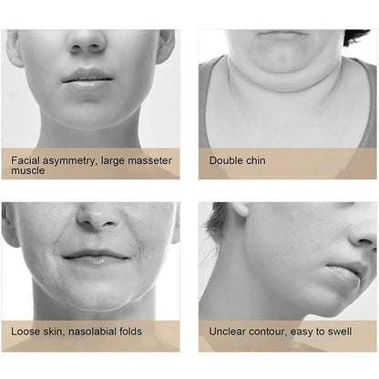 Infrared Face-Lifting Belt – Chin Tightening &amp; Skin Glow